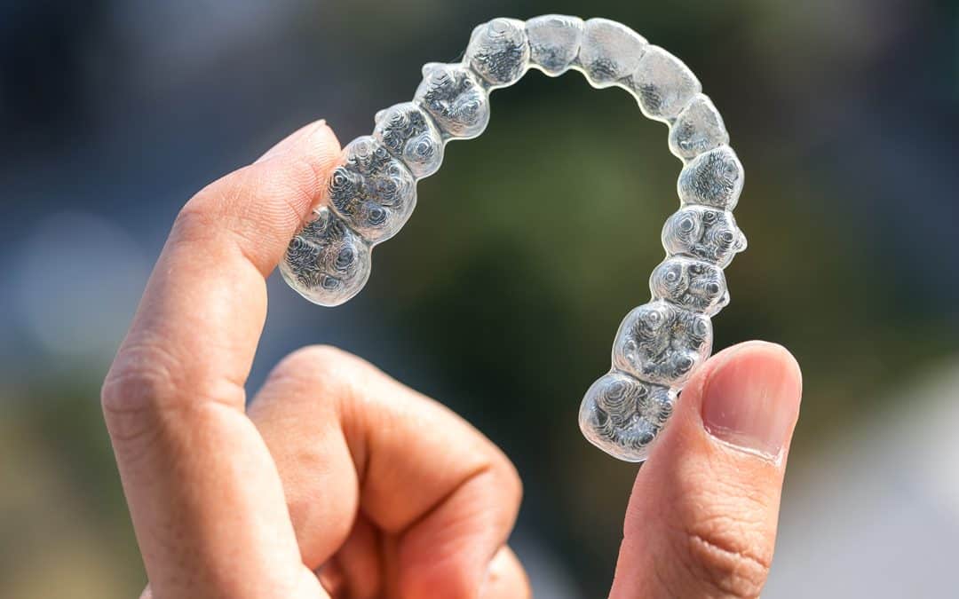 Cleaning and Maintaining Your Clear Aligner Trays