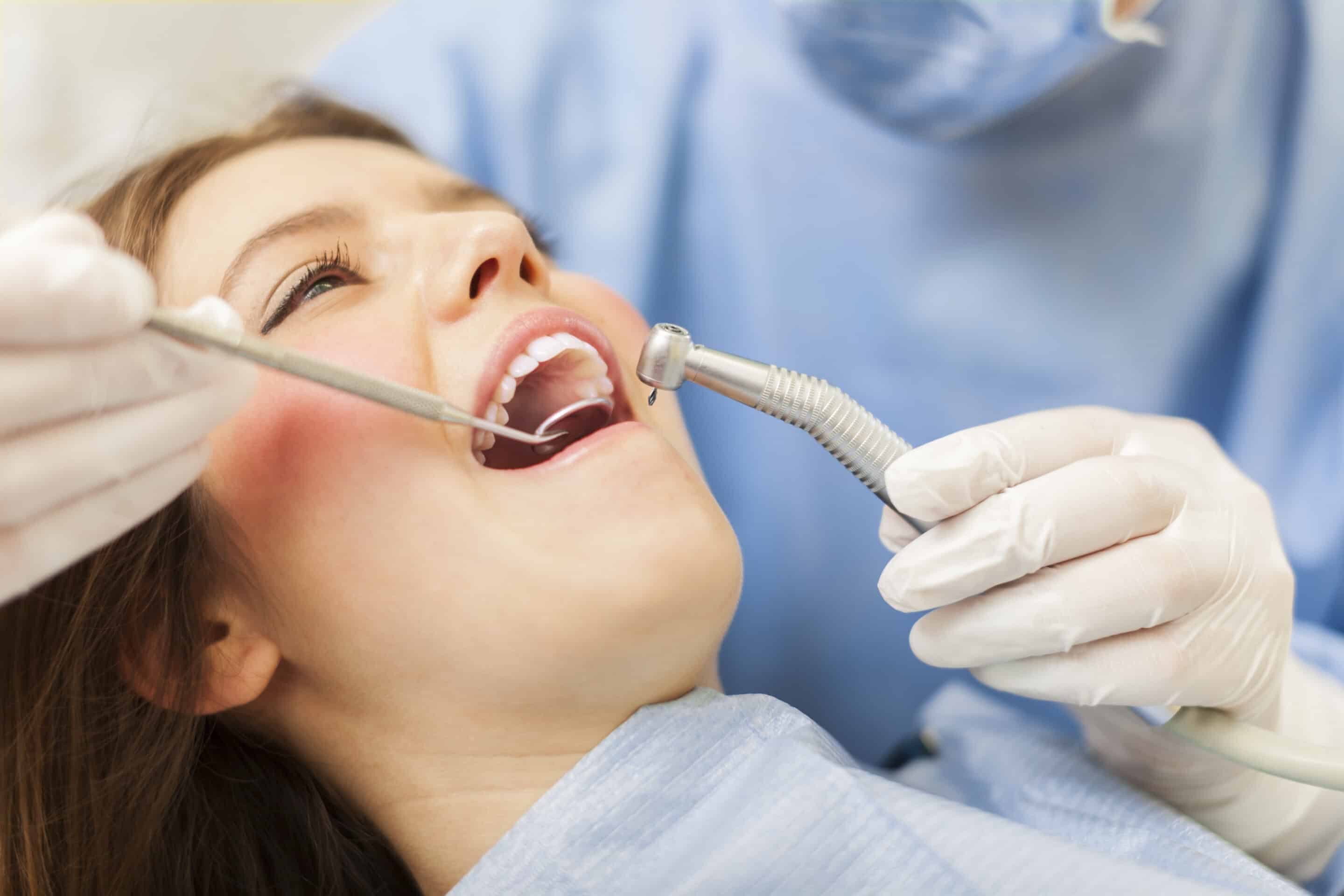 fillings dentist Olathe, KS